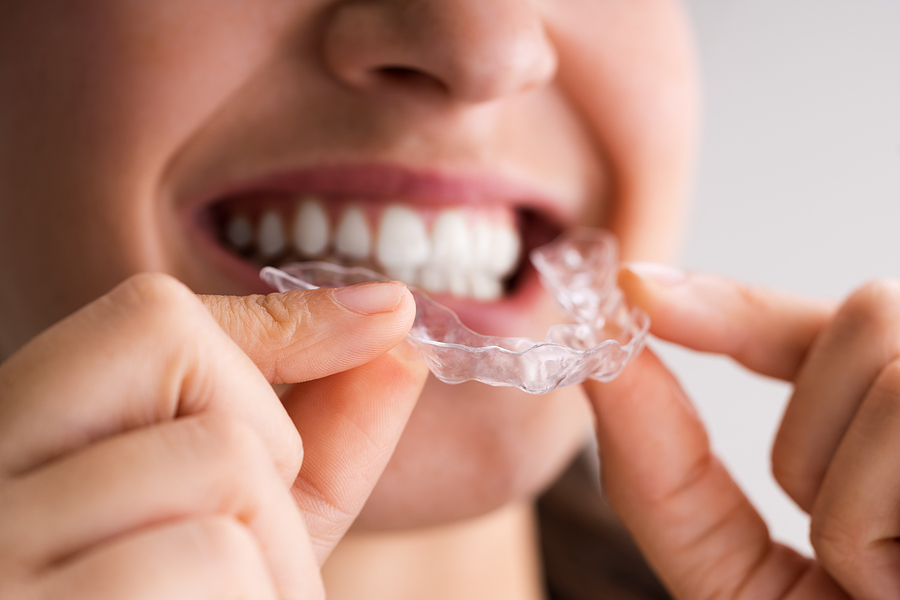 Top Mistakes That Lead to Orthodontic Emergencies (and How to Avoid Them)